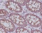 TOMM20 Rabbit mAb ABZ4878