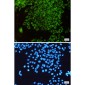 TOMM20 Rabbit mAb ABZ4879