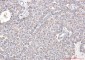 TOMM20 Rabbit mAb ABZ4879