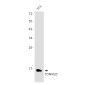 TOMM20 Rabbit mAb ABZ4879