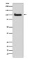 PKC mu/PKD Rabbit mAb ABZ4880