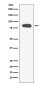 Stromal Interaction Molecule 1 Rabbit mAb ABZ4886