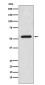 CaMKII Rabbit mAb ABZ4887