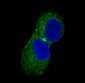 CaMKII Rabbit mAb ABZ4888