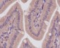 CaMKII Rabbit mAb ABZ4888