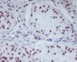HDAC1 Rabbit mAb ABZ4889