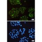SQSTM1/p62 Rabbit mAb ABZ4890