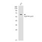 SQSTM1/p62 Rabbit mAb ABZ4890