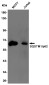 SQSTM1/p62 Rabbit mAb ABZ4890