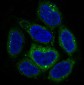 SQSTM1/p62 Rabbit mAb ABZ4891