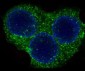 ROCK1 Rabbit mAb ABZ4892