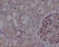 ROCK1 Rabbit mAb ABZ4892