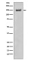 ROCK1 Rabbit mAb ABZ4892