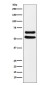 Ikaros Rabbit mAb ABZ4893