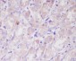 ILK Rabbit mAb ABZ4894