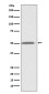 ILK Rabbit mAb ABZ4894