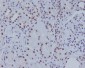 ASH2L Rabbit mAb ABZ4896