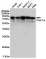 FOXO1 Rabbit mAb ABZ4900