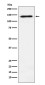 RNA Helicase A Rabbit mAb ABZ4902