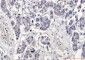 Bcl-XL Rabbit mAb ABZ4903