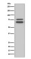 FMRP Rabbit mAb ABZ4905