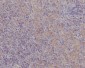 FAK Rabbit mAb ABZ4907