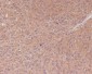 NF-KB p65 Rabbit mAb ABZ4909