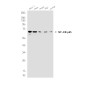 NF-KB p65 Rabbit mAb ABZ4909