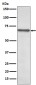 NF-KB p65 Rabbit mAb ABZ4909