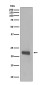 Caveolin-1 Rabbit mAb ABZ4910