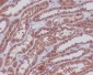 MEK1/2 Rabbit mAb ABZ4911