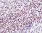 FLI1 Rabbit mAb ABZ4913
