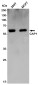 CAP1 Rabbit mAb ABZ4914