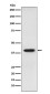 SET Rabbit mAb ABZ4917