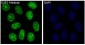 E2F1 Rabbit mAb ABZ4918