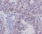 E2F1 Rabbit mAb ABZ4918
