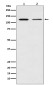 NF-KB p100 Rabbit mAb ABZ4919