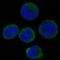 CDK6 Rabbit mAb ABZ4920