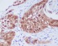 CDK6 Rabbit mAb ABZ4920