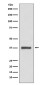 CDK6 Rabbit mAb ABZ4920