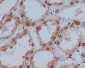 YB1 Rabbit mAb ABZ4923