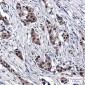 SUMO1 Rabbit mAb ABZ4925