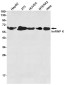hnRNP K Rabbit mAb ABZ4928