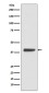 Islet 1 Rabbit mAb ABZ4932