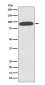 VCP Rabbit mAb ABZ4936