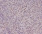 PMS2 Rabbit mAb ABZ4937