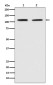 PMS2 Rabbit mAb ABZ4937