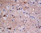 ATP Citrate lyase Rabbit mAb ABZ4938