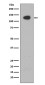 ATP Citrate lyase Rabbit mAb ABZ4938