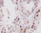 NUP98 Rabbit mAb ABZ4939
